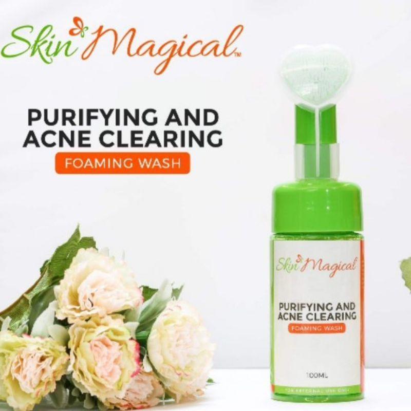 Skin Magical - Purifying and Acne Clearing Foam Wash - Pinoyhyper