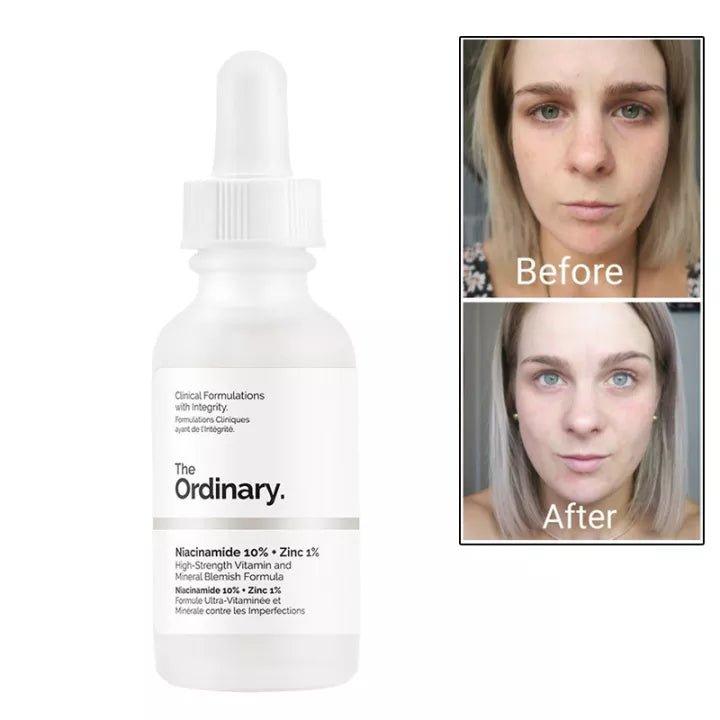 The Ordinary 3 IN 1 Vico Skin Care Peeling Solution Caffeine Solution & Niacinamide - 30ml - Pinoyhyper